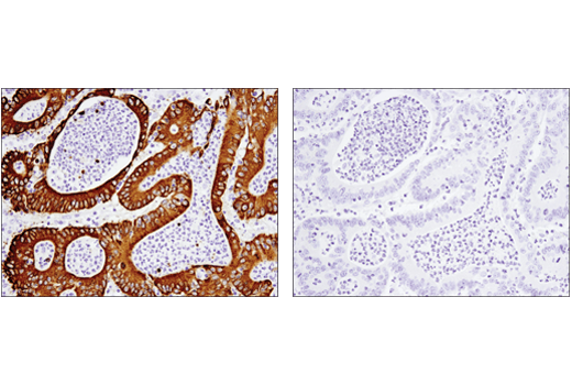 MUC5AC (E3O9I) XP ®  Rabbit mAb