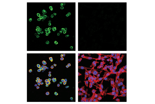 TGF-beta Fibrosis Pathway Antibody Sampler Kit