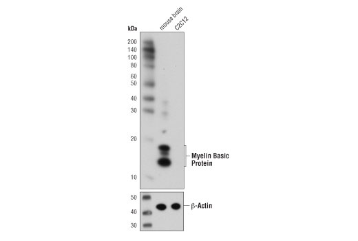 Myelin Basic Protein (D8X4Q) XP ®  Rabbit mAb
