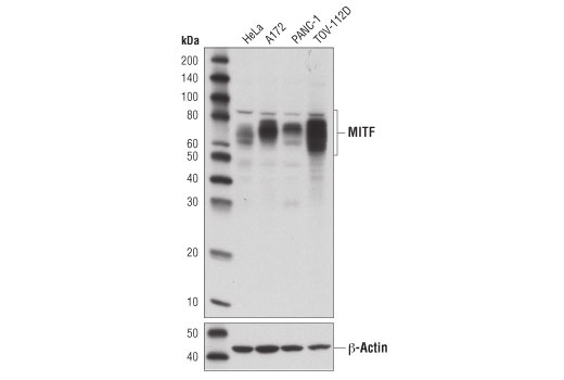 MITF (D3B4T) Rabbit mAb