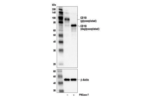 CD19 (Intracellular Domain) (D4V4B) XP ® Rabbit mAb