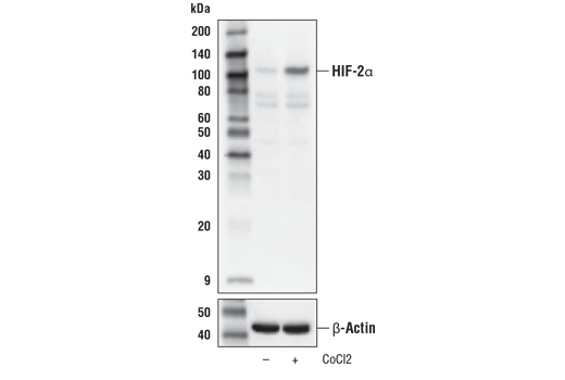 Hypoxia Pathway Antibody Sampler Kit