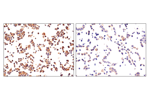 NF-kappaB Family Member Antibody Sampler Kit
