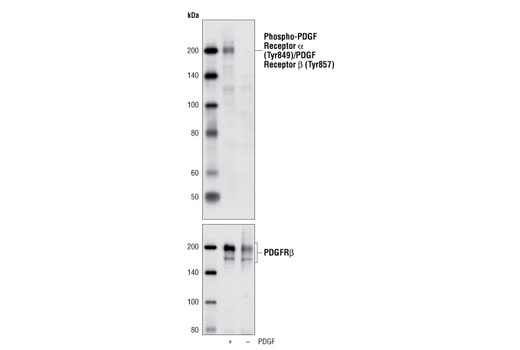 Phospho-PDGF Receptor alpha (Tyr849)/PDGF Receptor beta (Tyr857) (C43E9) Rabbit mAb