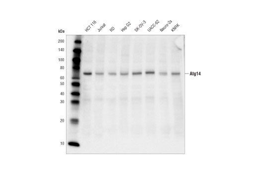 Beclin-1 Complex Antibody Sampler Kit