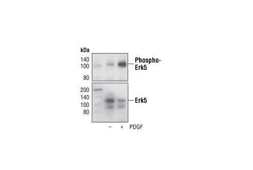 Phospho-Erk5 (Thr218/Tyr220) Antibody