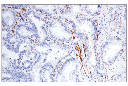 Exosomal Marker Antibody Sampler Kit