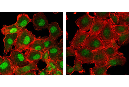 SMAD 1/5/9 Antibody Sampler Kit