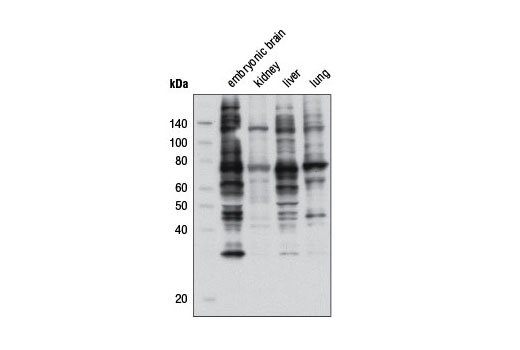 Phospho-PKC Substrate Motif [(R/K)XpSX(R/K)] MultiMab™ Rabbit mAb mix
