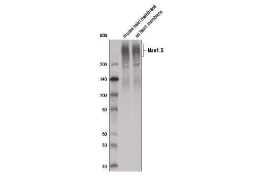 Nav1.5 (D9J7S) Rabbit mAb