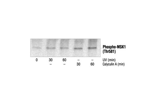 Phospho-Erk1/2 Pathway Antibody Sampler Kit