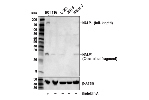 NALP1 (E3F2U) Rabbit mAb