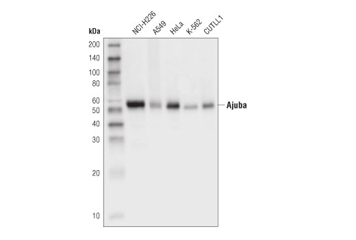 Hippo Pathway: Upstream Signaling Antibody Sampler Kit