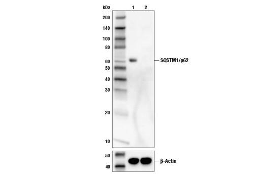 SQSTM1/p62 (D5L7G) Mouse mAb