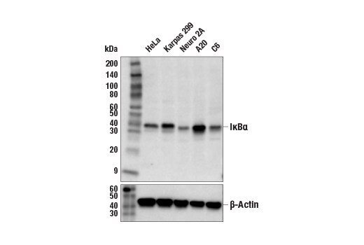 IkappaBalpha (44D4) Rabbit mAb