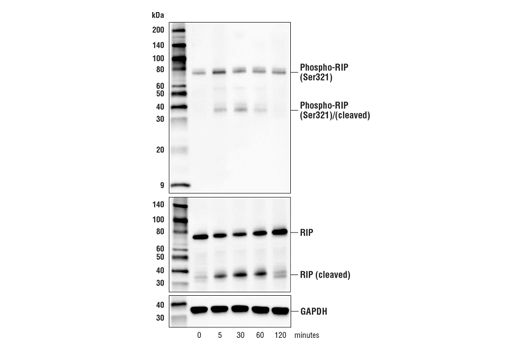 Phospho-RIP (Ser321) (E9K2A) Rabbit mAb