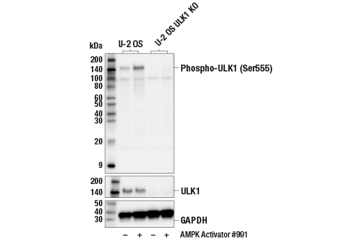 ULK1 Antibody Sampler Kit