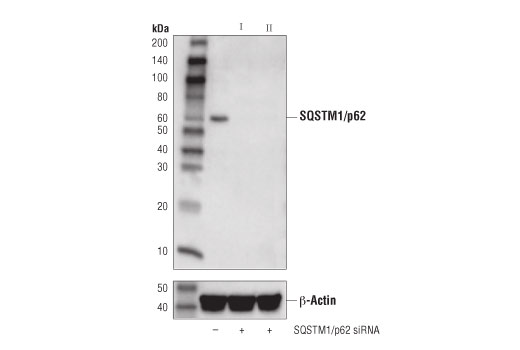 SQSTM1/p62 (D5L7G) Mouse mAb