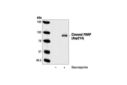 Apoptosis Antibody Sampler Kit (Mouse Preferred)