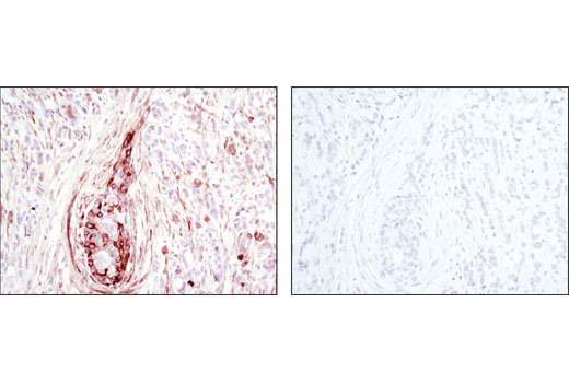 Phospho-p38 MAPK Pathway Antibody Sampler Kit