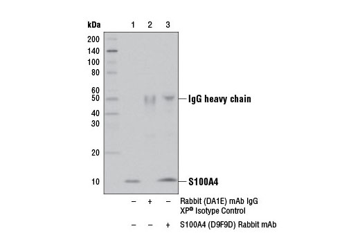 Cancer Associated Fibroblast Marker Antibody Sampler Kit