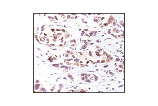 p53 Antibody Sampler Kit