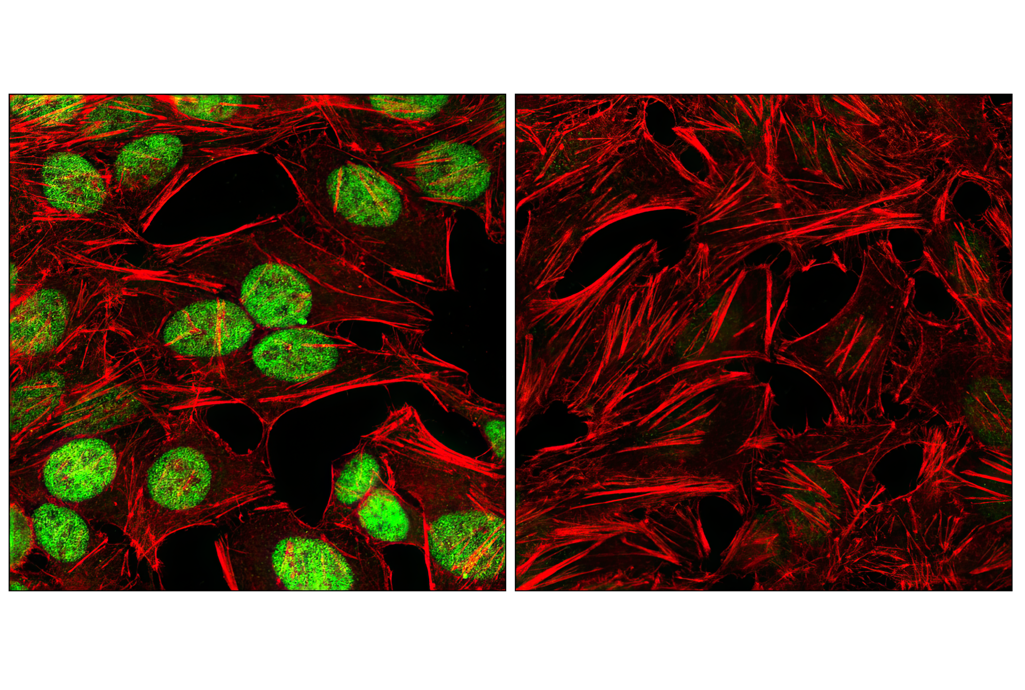 Notch Activated Targets Antibody Sampler Kit
