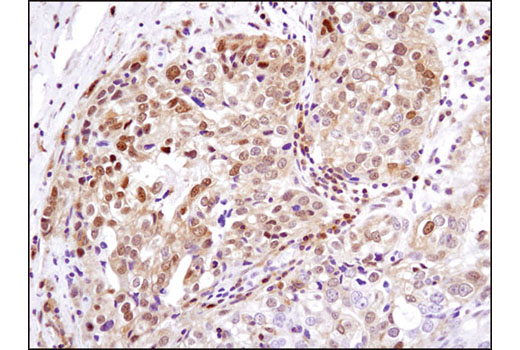 Phospho-Erk1/2 Pathway Antibody Sampler Kit