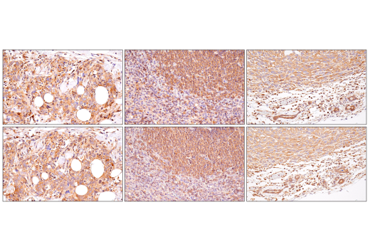 NF-kappaB Family Member Antibody Sampler Kit