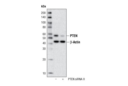 PTEN (138G6) Rabbit mAb