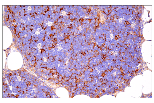 NF-kappaB Family Member Antibody Sampler Kit