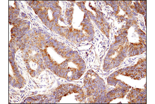 Pro-Apoptosis Bcl-2 Family Antibody Sampler Kit