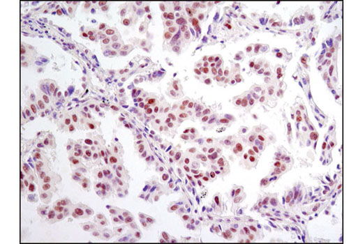 Hypoxia Pathway Antibody Sampler Kit