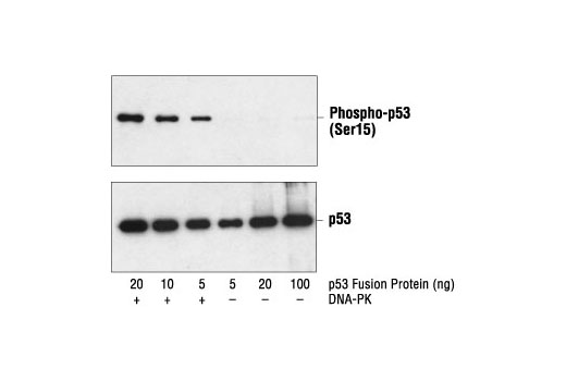 p53 Antibody Sampler Kit