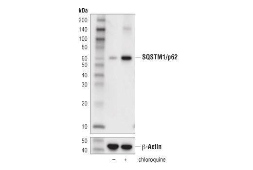 SQSTM1/p62 (D5L7G) Mouse mAb
