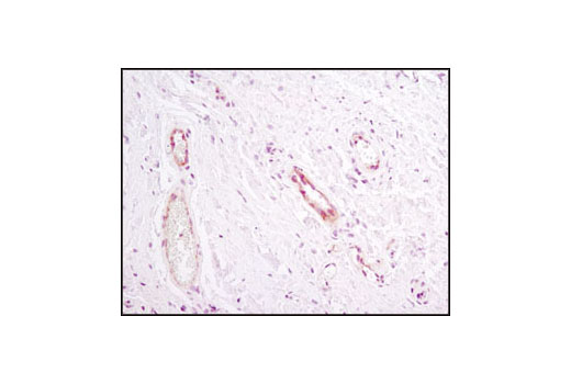 Notch Activated Targets Antibody Sampler Kit
