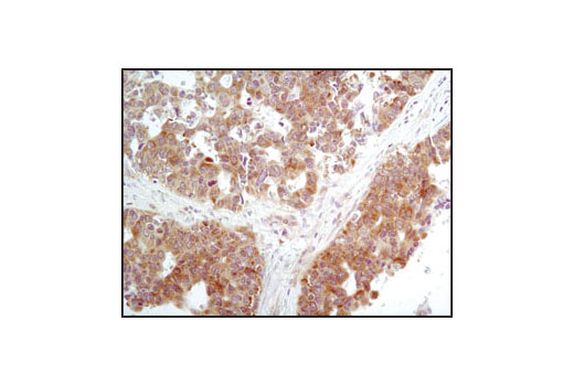 ER Stress-induced Autophagy Antibody Sampler Kit