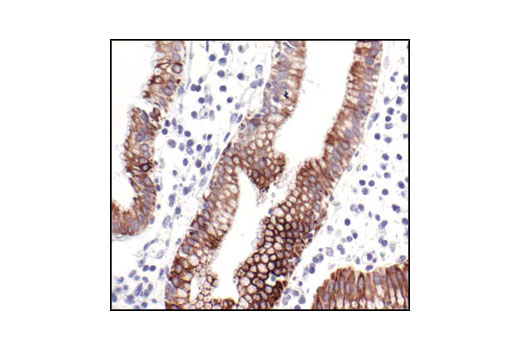 NF-kappaB Pathway Antibody Sampler Kit