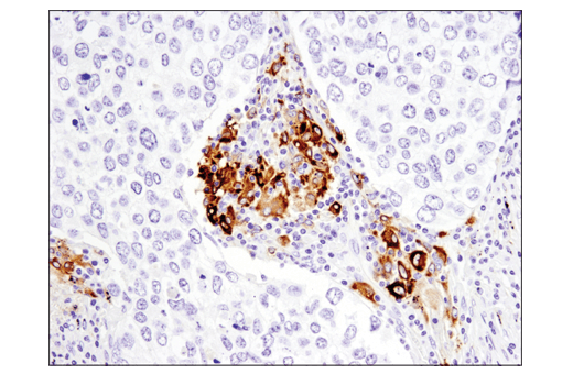 TGF-beta Fibrosis Pathway Antibody Sampler Kit