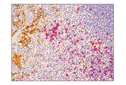 SignalStain ®  Boost IHC Detection Reagent (AP, Mouse)