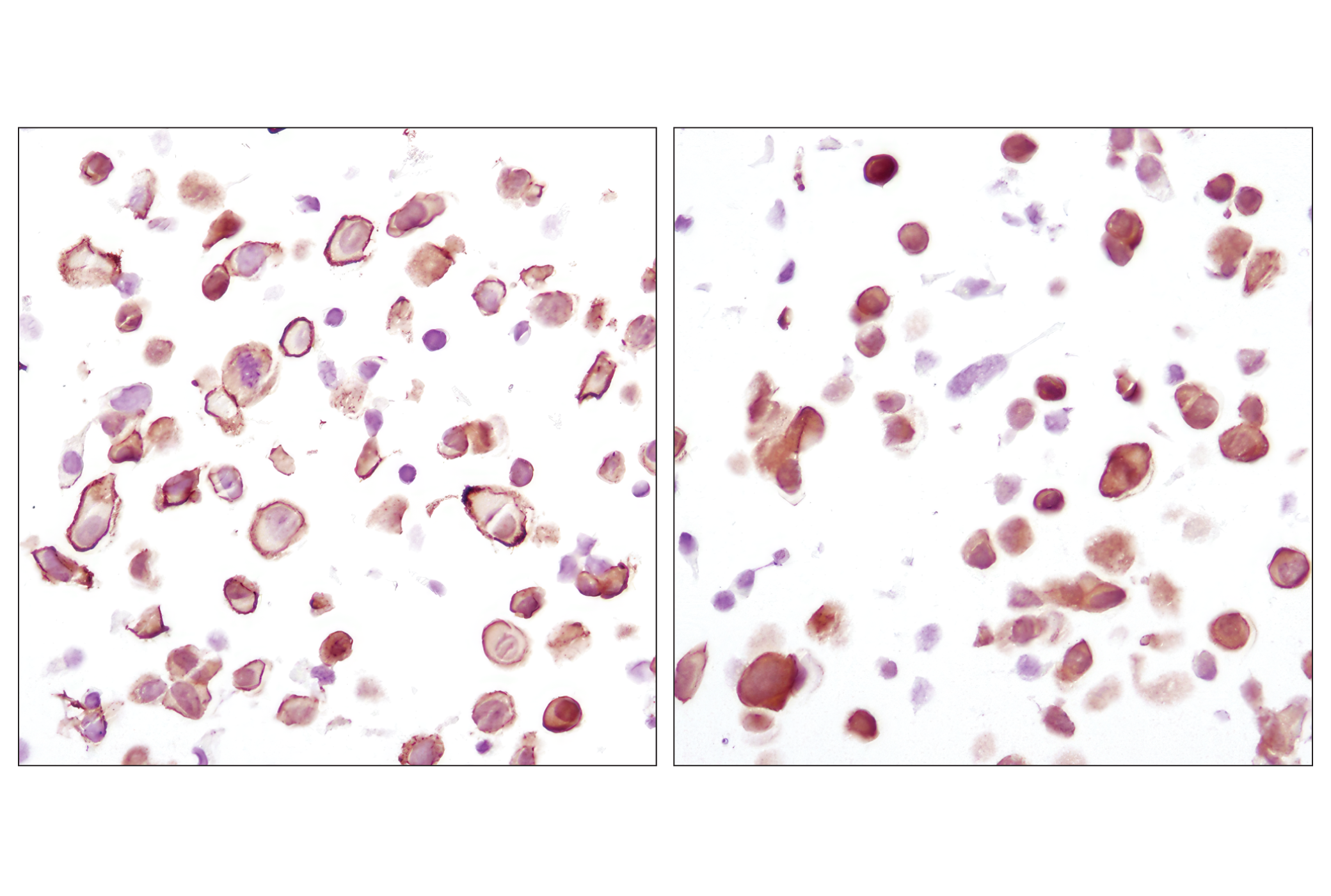 Phospho-Akt Isoform Antibody Sampler Kit