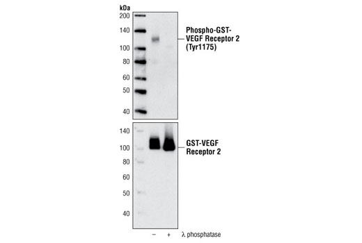 VEGF Receptor 2 Control Proteins