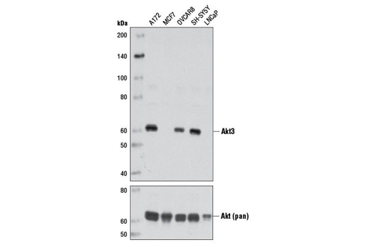 Akt Isoform Antibody Sampler Kit
