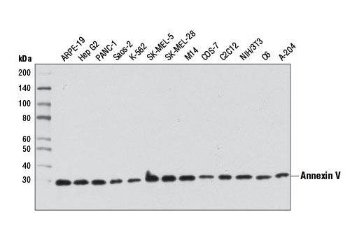 Exosomal Marker Antibody Sampler Kit