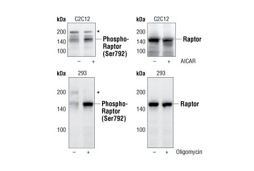 ULK1 Antibody Sampler Kit