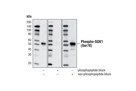 Phospho-SGK1 (Ser78) (D36D11) Rabbit mAb