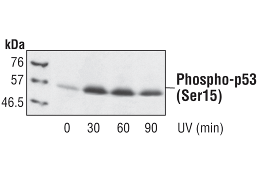p53 Antibody Sampler Kit