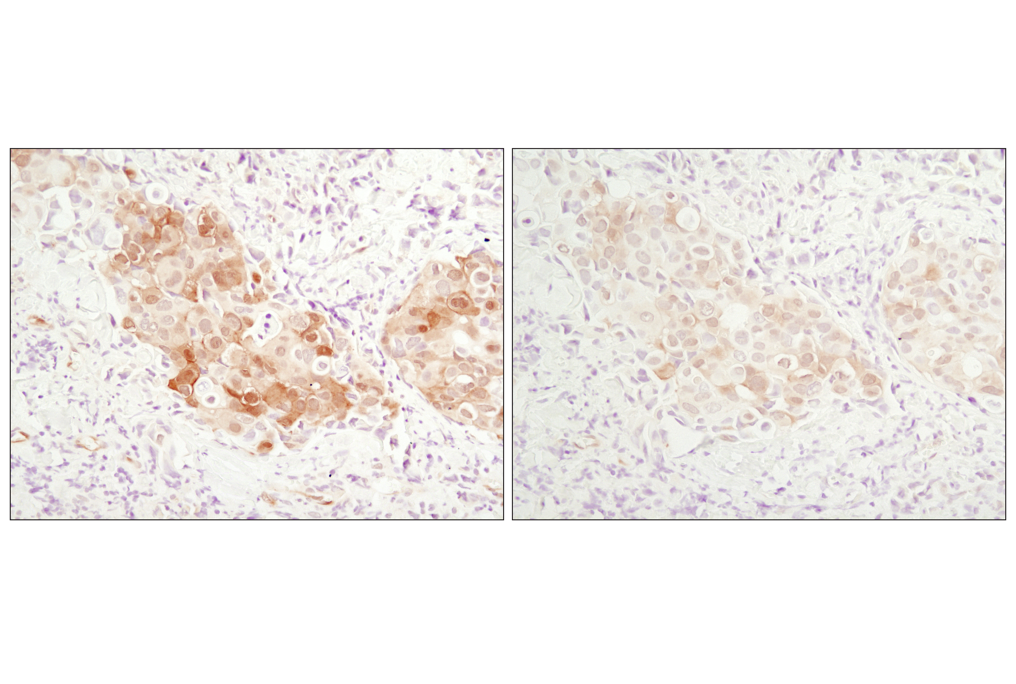 Angiogenesis Antibody Sampler Kit