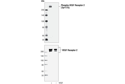 Angiogenesis Antibody Sampler Kit