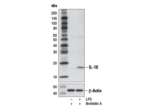 IL-10 (D13A11) Rabbit mAb